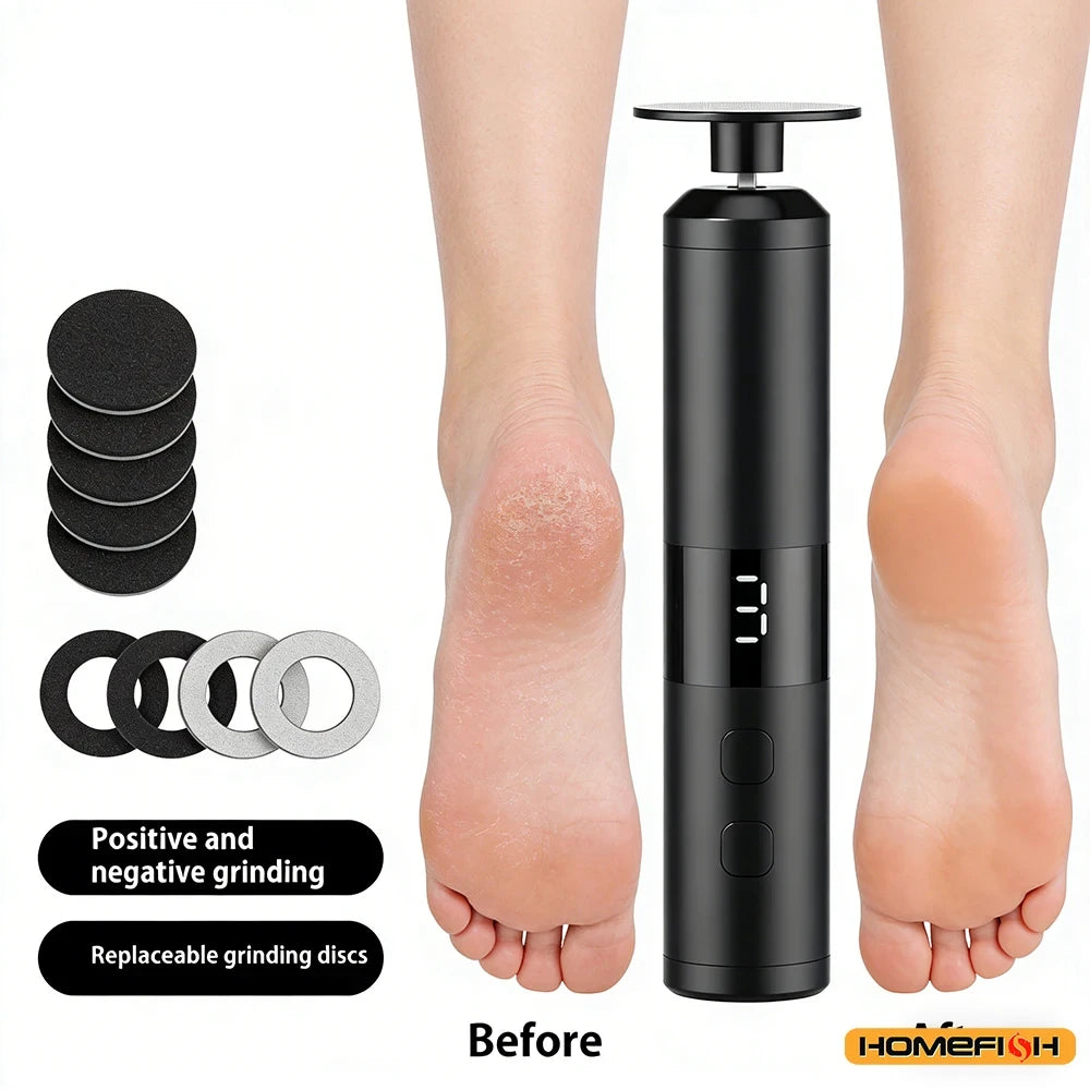 Electric Callus Remover
